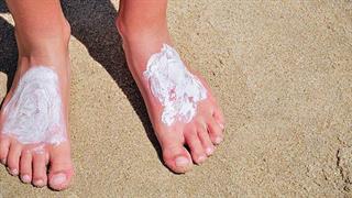 Πώς αντιμετωπίζουμε τα ηλιακά εγκαύματα