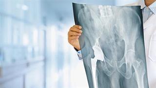 Πρωτοποριακή τεχνολογία εξομοίωσης των αρθροπλαστικών ισχίου και γόνατος βελτιώνει τις αρθροπλαστικές