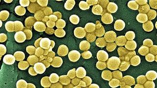 Roche: Νέο τεστ ανιχνεύει τις σοβαρότερες ενδονοσοκομειακές λοιμώξεις