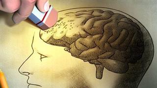 10 αρχικά συμπτώματα άνοιας