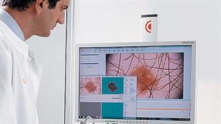 Έγκαιρη διάγνωση μελανώματος με χαρτογράφηση σπίλων!