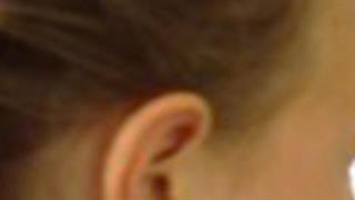 Ποιες βελτιώσεις στο rebate των γιατρών συζητεί ο υπουργός Υγείας