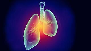 Διάγνωση του καρκίνου στον πνεύμονα με τη θερμοκρασία της εκπνοής