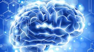 Το σύνδρομο Down βοηθά στην κατανόηση της νόσου Alzheimer