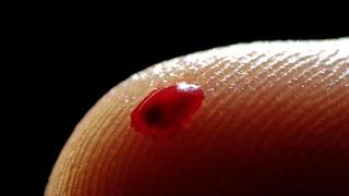 Πολυμερικό υλικό σταματά την αιμορραγία των πληγών 