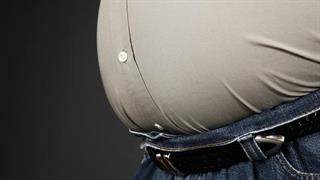 Νοσογόνος παχυσαρκία: Οι καινούργιες μέθοδοι χειρουργικής αντιμετώπισης