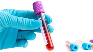 AIDS: Πρόβλημα πρόσβασης στις θεραπείες για τους μετανάστες