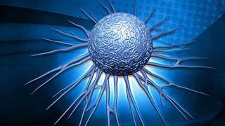 Ίδρυση Επιτροπής για την Πρόληψη του Καρκίνου Παχέος Εντέρου 