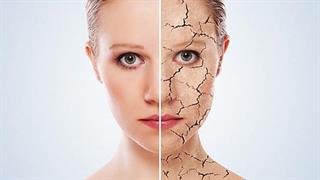 12 καταστροφικά αποτελέσματα της αφυδάτωσης