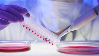 Bristol Myers Squibb: Εγκαταλείπει την έρευνα στην ιολογία