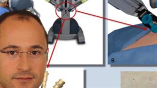 Στην Ελλάδα η πρώτη ρομποτική ουρολογική επέμβαση μίας τομής στη νοτιοανατολική Ευρώπη