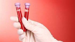 Απλή εξέταση αίματος αντί βιοψίας για τον καρκίνο
