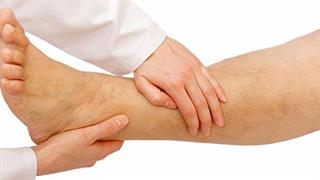 Θρόμβωση: Σκοτώνει έναν στους τέσσερις ανθρώπους σε όλο τον κόσμο