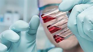 Πιο κοντά εξέταση αίματος για τη νόσο Alzheimer