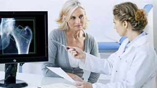 Οστεοπόρωση: Τι την προκαλεί και πώς να την προλάβετε