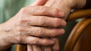 Έρευνα συνδέει τη ρευματοειδή αρθρίτιδα με αυξημένο κίνδυνο πρόωρου θανάτου   