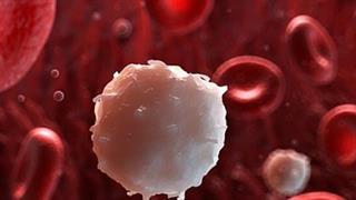 Λευχαιμία: Αξιοσημείωτα αποτελέσματα έχει πειραματική θεραπεία με Τ- κύτταρα