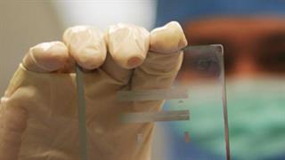 Έρευνα ΟΟΣΑ: Μεγάλος κίνδυνος για την υγεία από νανοϋλικά που καταλήγουν στο περιβάλλον