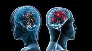 Η εν τω βάθει εγκεφαλική διέγερση στη θεραπεία του Parkinson και της δυστονίας
