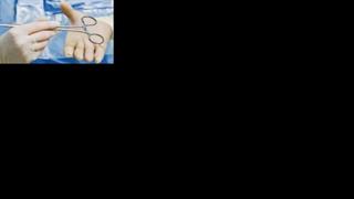 Σε θολά νερά η χρηματοδότηση του συστήματος περίθαλψης των ανασφάλιστων πολιτών