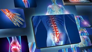 Οστεοπόρωση: Επιβαρυντικοί παράγοντες