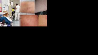 Νέο κρούσμα επίθεσης σε γιατρό – Σοκαρισμένο το προσωπικό του Κέντρου Υγείας Σερβίων 