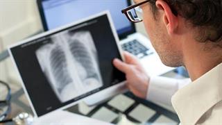 Εξελίξεις στη θεραπεία του καρκίνου του πνεύμονα