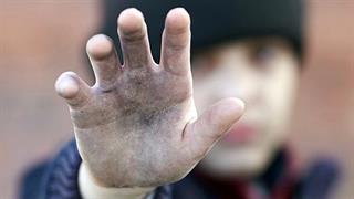 Γ. Πατούλης: Έκθεση- κόλαφος αποκαλύπτει τις τραγικές συνθήκες υγιεινής στα Κέντρα Φιλοξενίας Προσφύγων