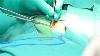 Κήλη: Ο ρόλος των βαρών και η χειρουργική αντιμετώπιση