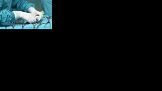 Το χάος με τις επεμβάσεις στα νοσοκομεία: Εμπλοκή μεταξύ πανεπιστημιακών - κλινικών ΕΣΥ