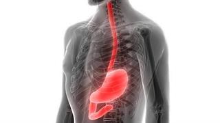 Πρωτοποριακή ρομποτική επέμβαση για αντιμετώπιση καρκίνου του οισοφάγου