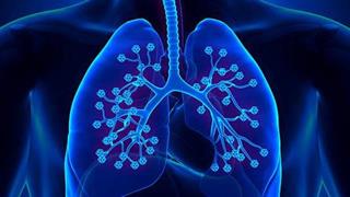Το pembrolizumab έλαβε έγκριση από τον FDA ως θεραπεία πρώτης γραμμής για τον καρκίνο του πνεύμονα 