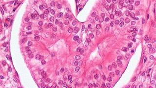 ‘Εκθεση ‘’Ιστολογική εικόνα και Τέχνη’’