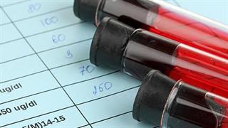 Εξέταση αίματος για την κρυμμένη καρδιοπάθεια