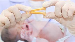 ACOG: Η καθυστερημένη απολίνωση του ομφάλιου λώρου ωφελεί τα μωρά