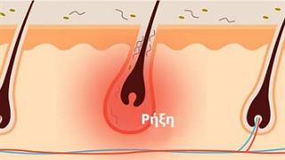 ‘’Τι σημαίνουν τα συμπτώματά μου’’