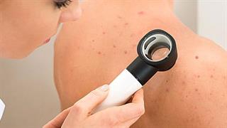 Το δέρμα σαν τα ...μάτια σας