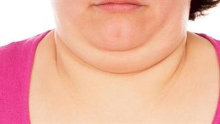 Πώς να χάσω το διπλοσάγονο