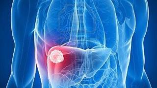 325 εκατομμύρια άνθρωποι νοσούν από τον ιό της ηπατίτιδας Β και C 