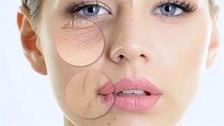 Πώς θα φροντίσετε το δέρμα σας μετά τη θεραπεία για καρκίνο