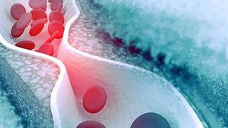 Ερευνητές αναπτύσσουν εμβόλιο κατά της αρτηριοσκλήρυνσης