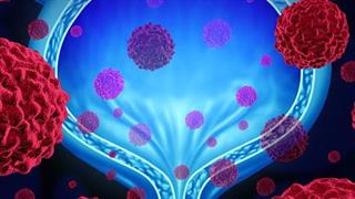 Η Ευρωπαϊκή Επιτροπή εγκρίνει το nivolumab για το ουροθηλιακό  καρκίνωμα