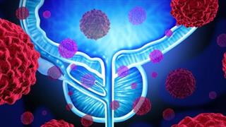 Καρκίνος του προστάτη: Πώς θα τον προλάβουμε;