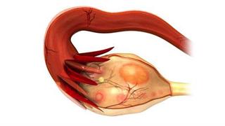 Υπογονιμότητα: Ποια είναι τα ύποπτα συμπτώματα σε άνδρες και γυναίκες