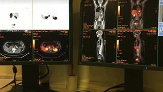 “Ευαγγελισμός”: Πρωτοποριακή εξέταση PET/CT, με 40% μεγαλύτερη ακρίβεια διάγνωσης καρκίνου