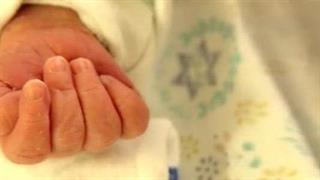Σπάνια επέμβαση στο Hadassah σε βρέφος που ακόμα ήταν στην κοιλιά της μητέρας
