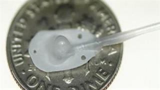 Συσκευή εμφυτεύεται στην καρδιά και χορηγεί φάρμακο