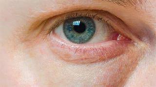 Μυστικά «ασπίδα» στη γήρανση: H φόρμουλα νεότητας