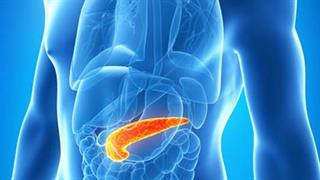 Η έναρξη διαβήτη μετά τα 50 θα μπορούσε να είναι πρώιμο σημάδι καρκίνου στο πάγκρεας