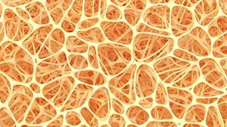 Προβιοτικά κατά της οστικής απώλειας σε γυναίκες μεγαλύτερης ηλικίας